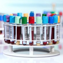 A carousel of test tubes